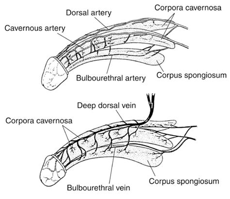 penil dorsal ven ligasyonu nedir